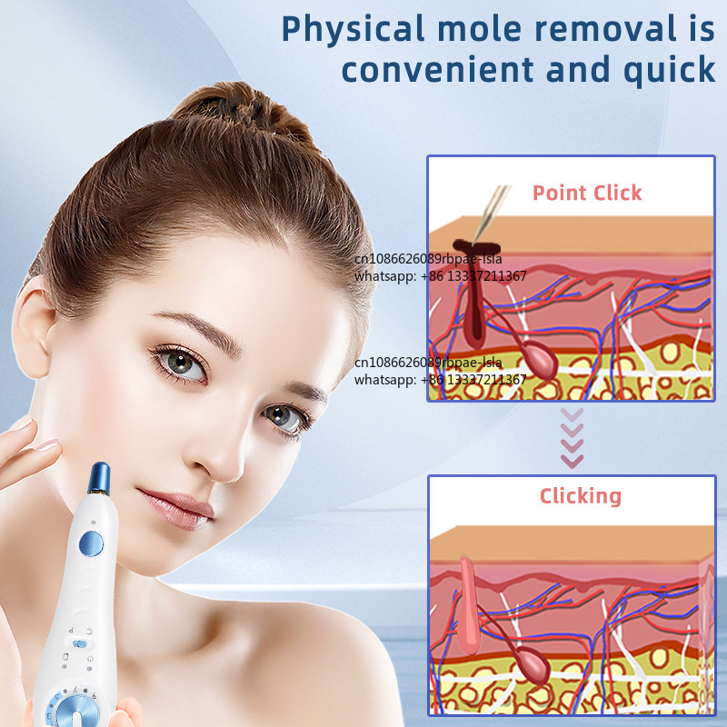 Pena Plasma 500Hz Pulse Cold F - Plasma Pen Fibroblast Eyelid Lift ulasan dan harga