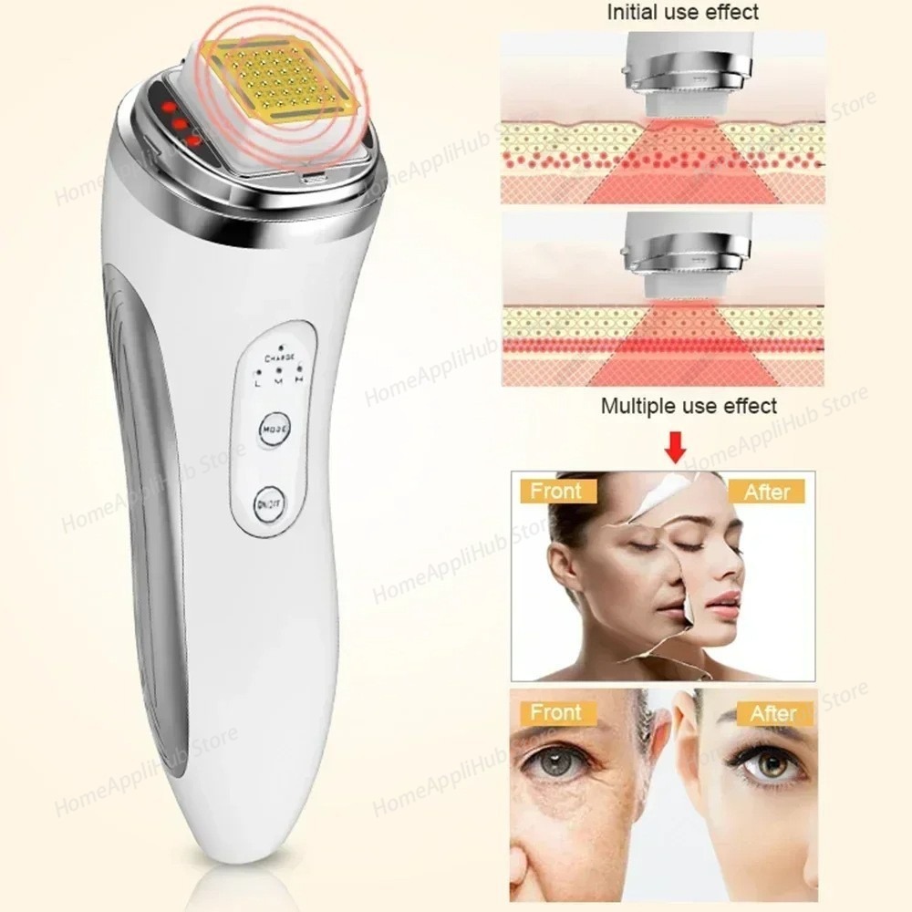 Alat Pengencang Wajah dengan T - Radio Frequency Face Lift Machine ulasan dan harga